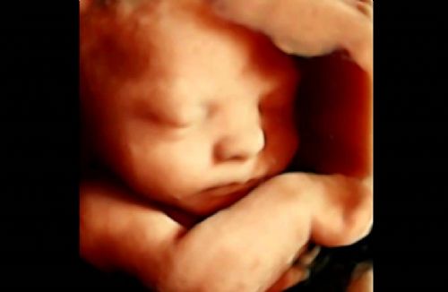 Harvard Law Journal Article Concludes Unborn Babies Have Constitutional Rights