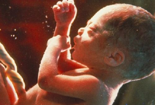 Judge May Block Abortion Pill Nationwide, Saving Millions of Unborn Babies