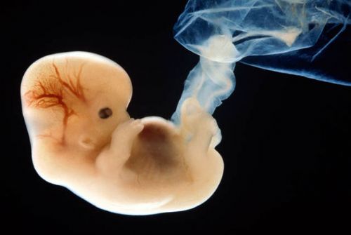 Florida Senate Committee Passes Bill Banning Abortions When Unborn BabyÃ¢â'¬â¢s Heart Begins Beating