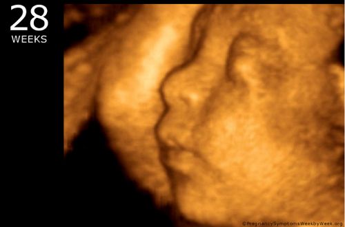 The Abortion Clinic Offered to Kill My 28-Week-Old Baby in an Abortion for $11,400 No Questions Asked