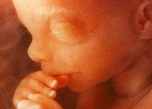 Catholic Bishops Say Killing Babies in Abortions Can Never be a Fundamental Right